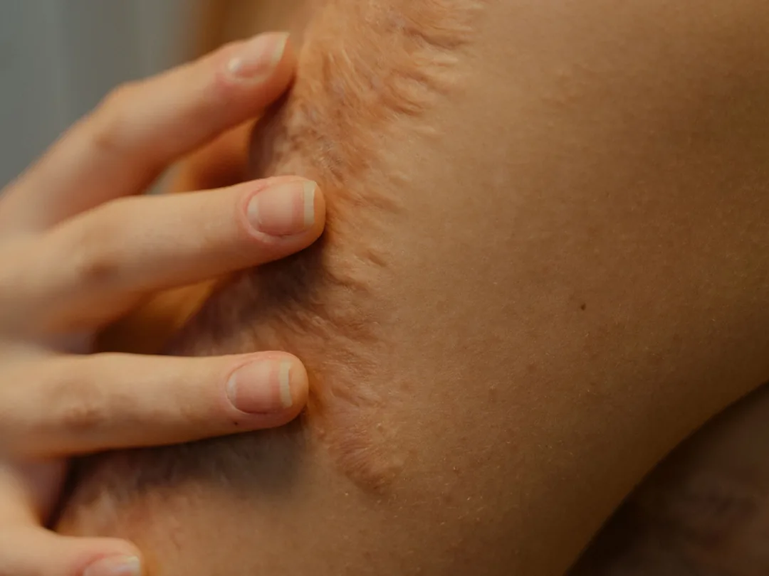 Rehabilitacja pooperacyjna